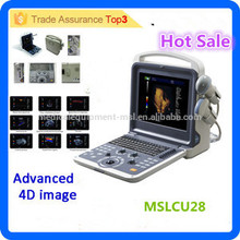 MSLCU28i New style & tech 3D 4D Color Doppler Ultrasound Scanner Portable Ultrasound Machine with Cheap Price